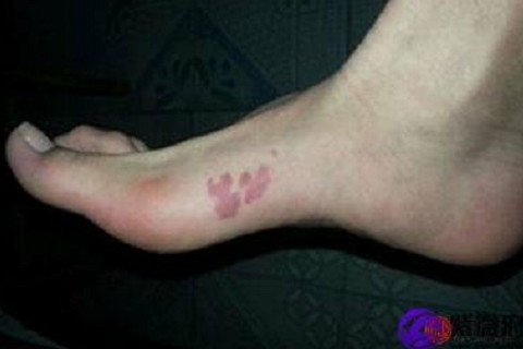 腳背長毛是福還是禍?腳背長毛的人的命運