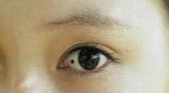 女人面相痣解析女人臉上的大吉之痣,女相面部痣