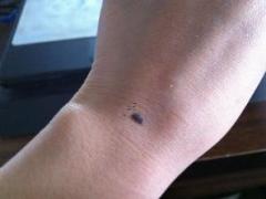 耳朵里長黑痣代表什么,耳朵里面長黑痣代表什么